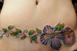 tatuajes para tapar cesareas horizontal