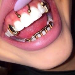 La extravagancia de los piercing en los dientes