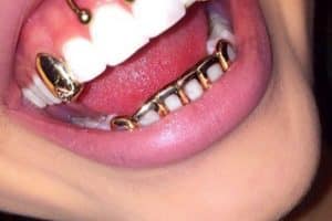 piercing en los dientes dorado