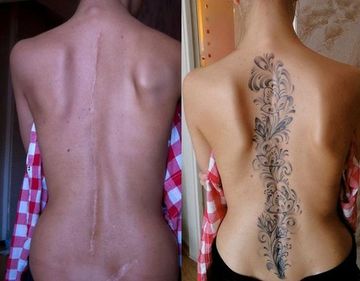 tatuajes que cubren cicatrices en la espalda